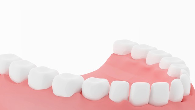 纠结做牙冠还是牙嵌体,做牙冠和嵌体后的后遗症