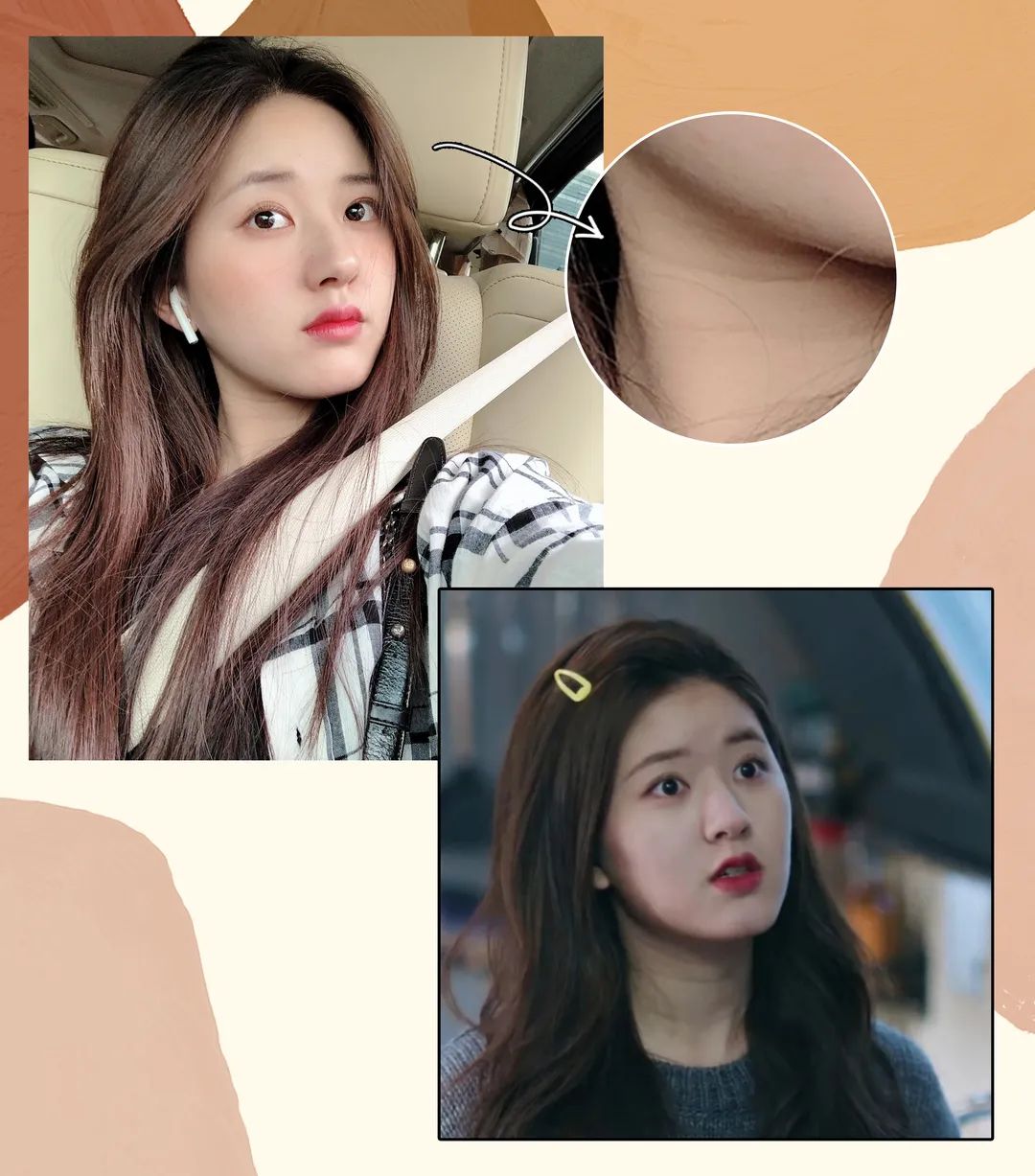 1条颈纹=显老10岁，可怕的颈纹还有救吗？