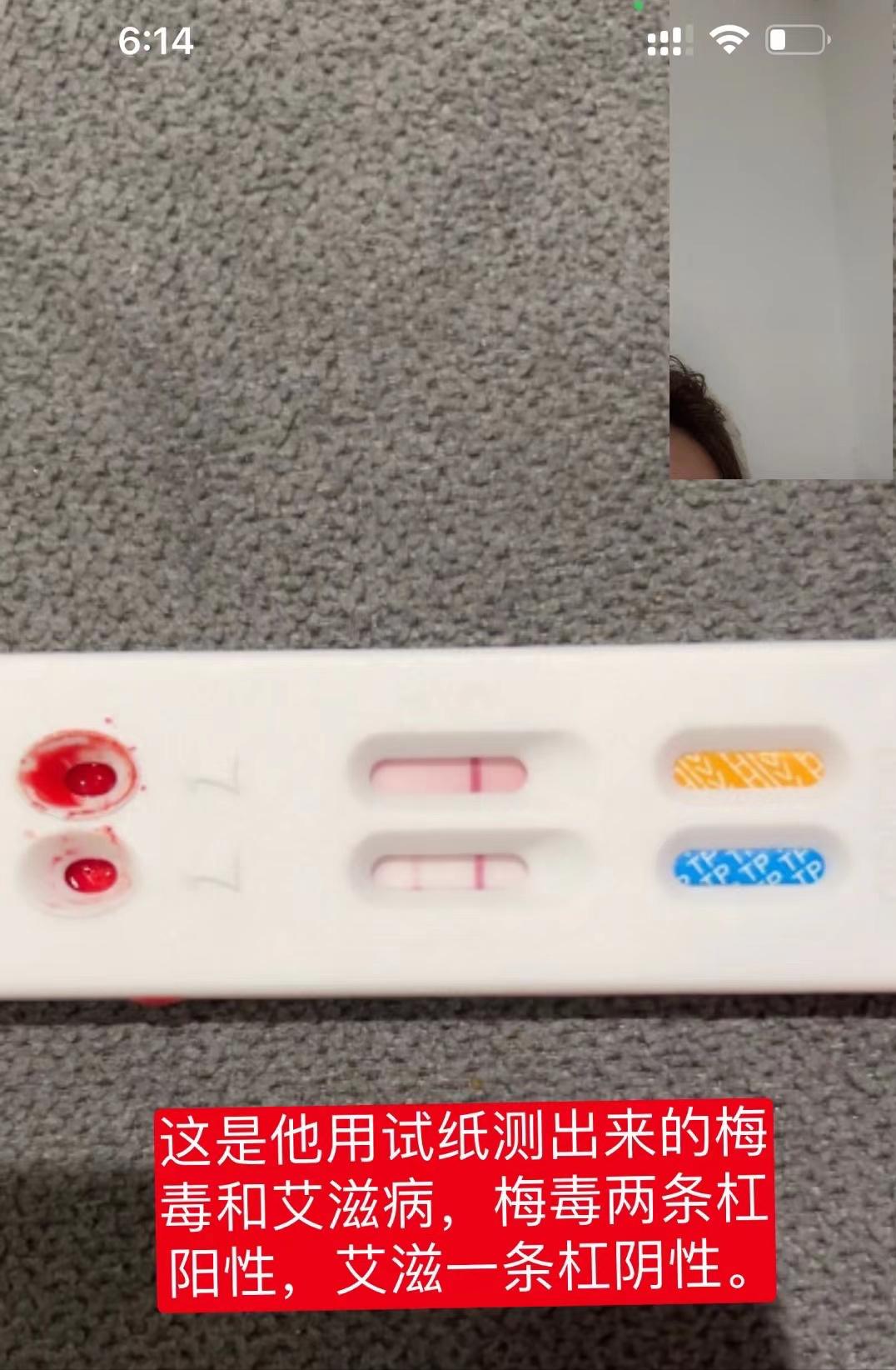 长春亚泰门将低级失误,长春亚泰门将受伤