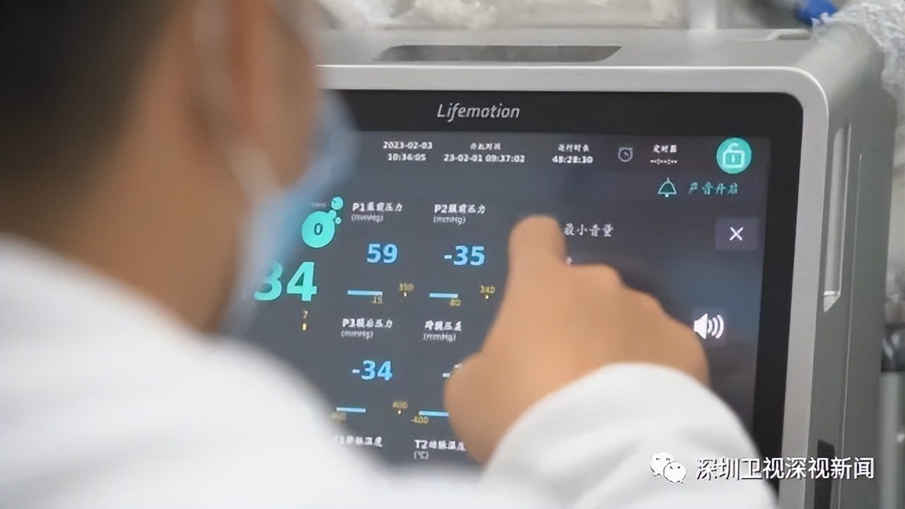 首例国产ecmo,国内首部自主研发ecmo