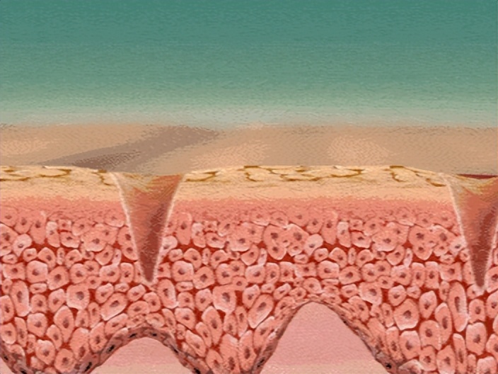 外阴白斑治疗的真实案例,外阴白斑的讲解