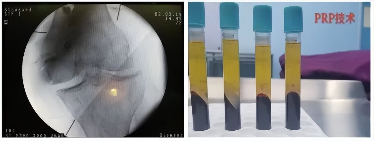 疼痛难忍最好的治疗方法,疼痛难忍的治疗