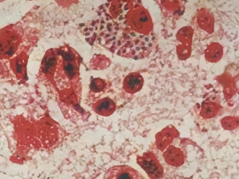 五种病,能通过“性传播”,你知道几个?医生劝告:别太放纵自己