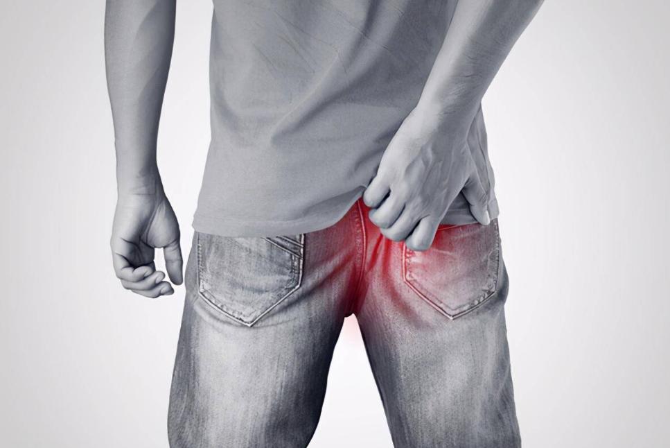 肛门癌与痔疮的症状和前兆,不要错把癌症当痔疮