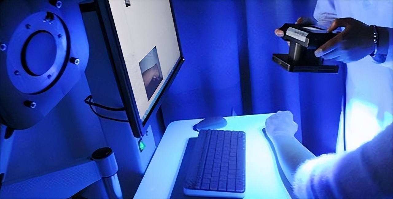 孩子脸上长白斑怎么解释,孩子脸上长白斑一定是白癜风吗