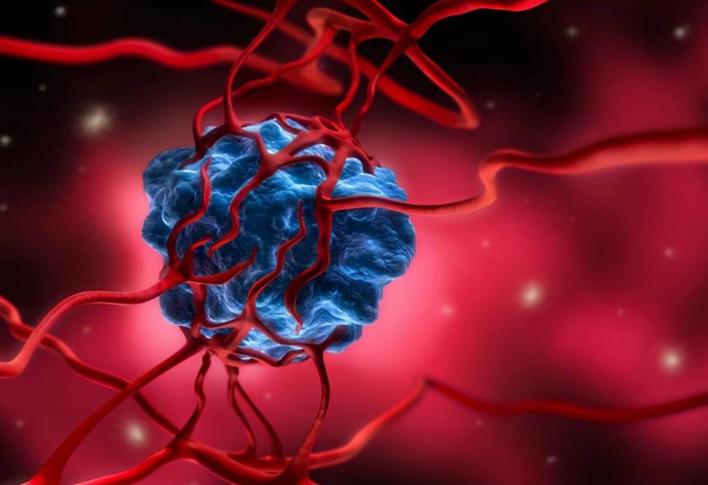 这8个部位长痣或是癌症前兆,痣长在身体这8个部位要小心癌症