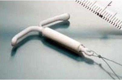 例假结束后十天有褐色分泌物腹痛,为什么例假后分泌物是咖啡色