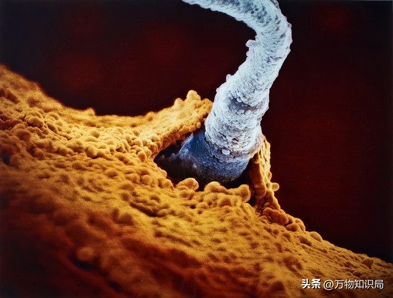 进入女性体内后，没“受精”成功的精子都去哪儿了？既好笑又心疼