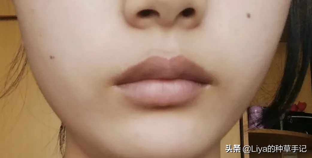 扁平脸如何拯救,扁平脸修复方法图解