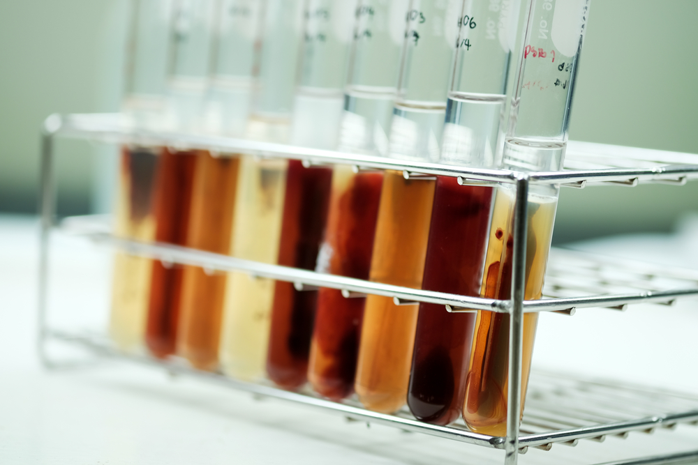 虾青素能抗应激吗,虾青素能抗氧化抗衰老吗