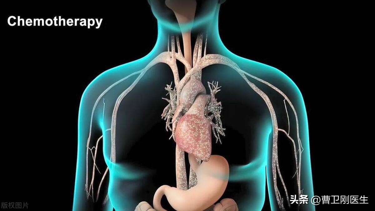 luminala型乳腺癌术后肺转移,luminab型乳腺癌肺转移治疗