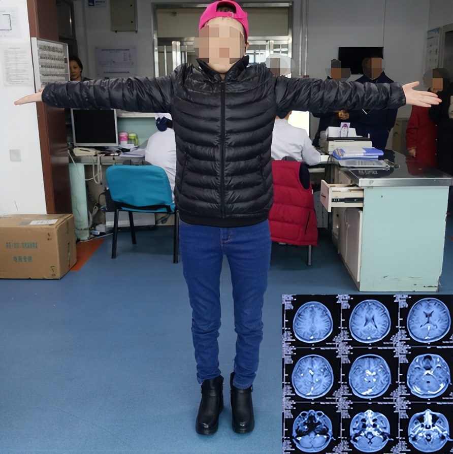 结核性脑积水能治愈吗,儿童结核脑膜炎脑积水