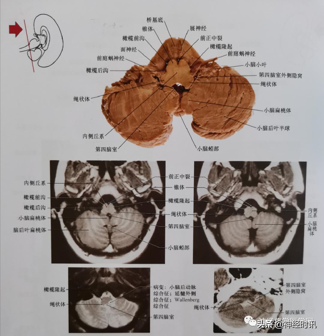 ct袖珍断层解剖图谱最新版,头颅ct断层解剖图谱无水印