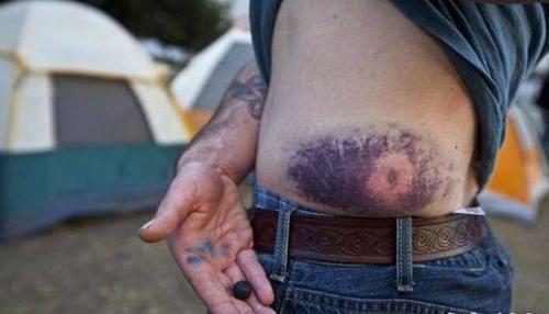 当你被枪击后到底是什么感受,当你被枪击中后的感觉