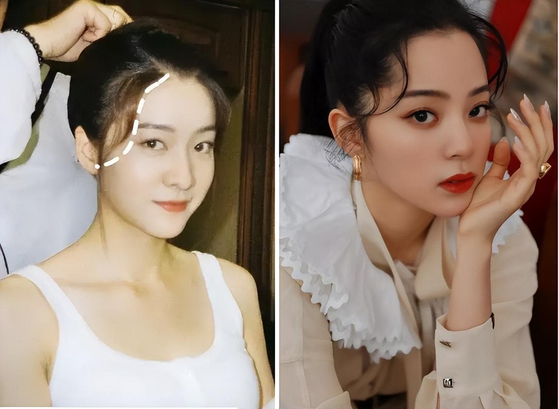 为什么大部分亚洲人都是扁头,正脸好看但侧脸丑到爆怎样办