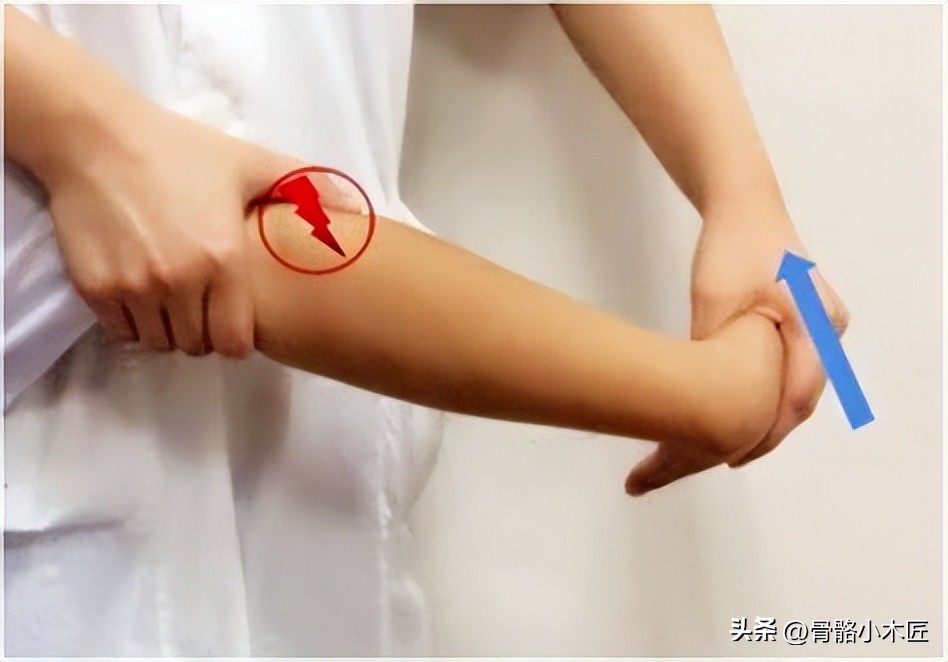 外伤肱骨外上髁炎,运动损伤的骨膜炎怎么治