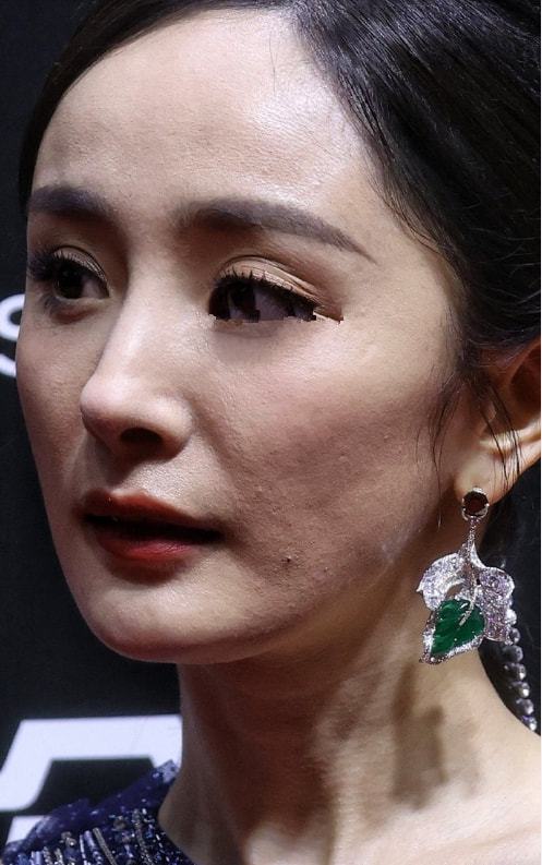 脸上有痘坑的明星,脸上爆痘特别多还好看的明星