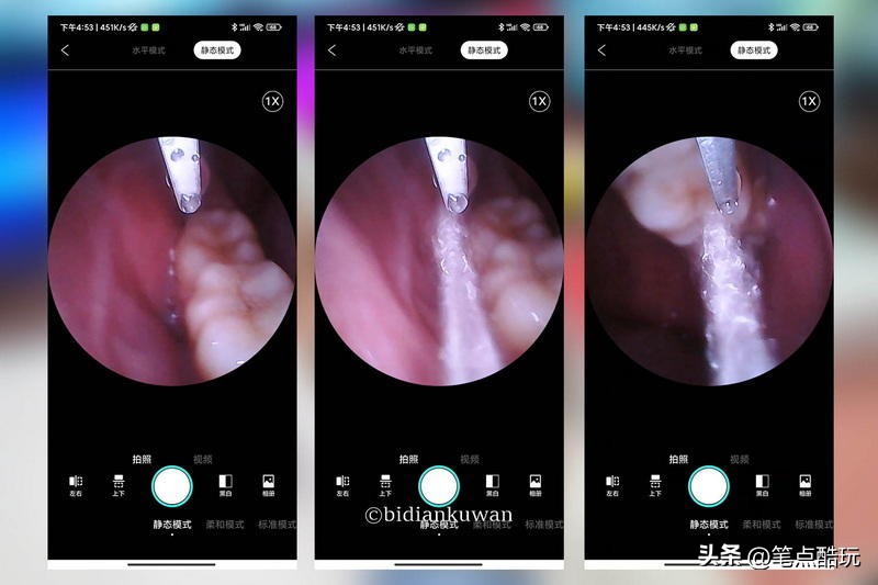 可视牙菌斑清洁仪,洁牙仪除牙垢视频