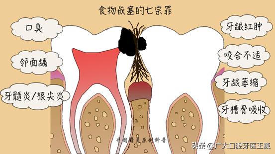 牙疼想知道自己是哪种牙疼,牙疼不是病疼起来简直真的要人命