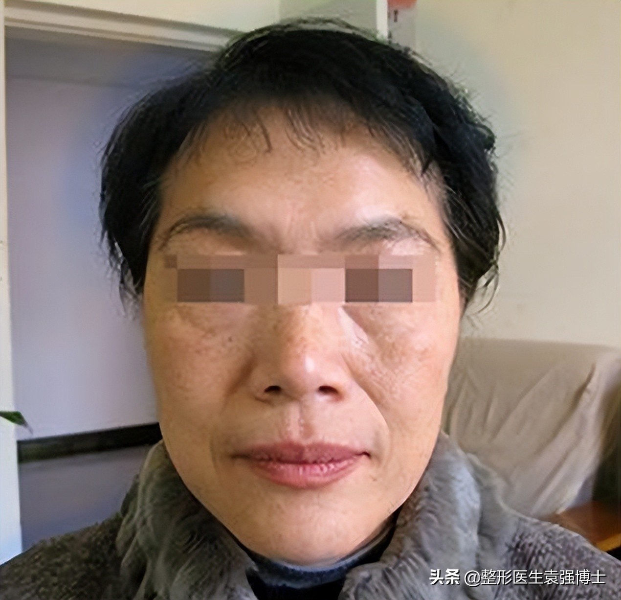 40岁松弛怎么恢复,40岁松弛下垂怎么恢复