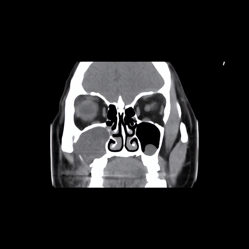 面部肿胀但是不痛是什么原因啊,面部肿胀3年了是什么原因啊