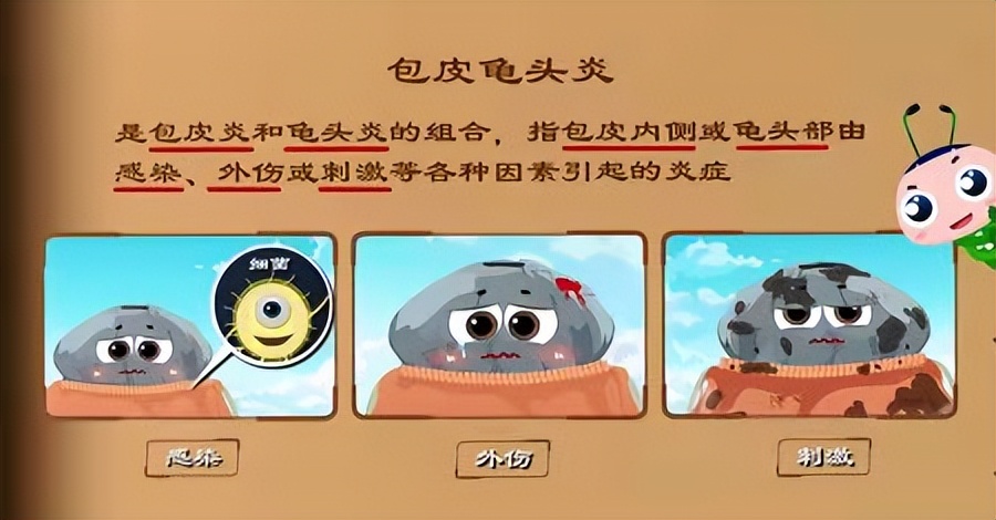 “丁头”发“炎”怎么办？—氦氖激光照射治疗为您排忧解“男”