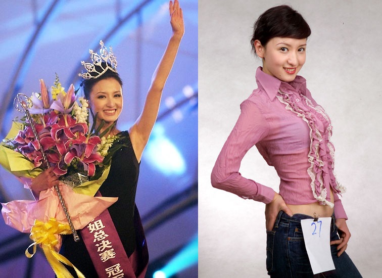 最近脸僵硬的女星,脸部变僵硬的女明星