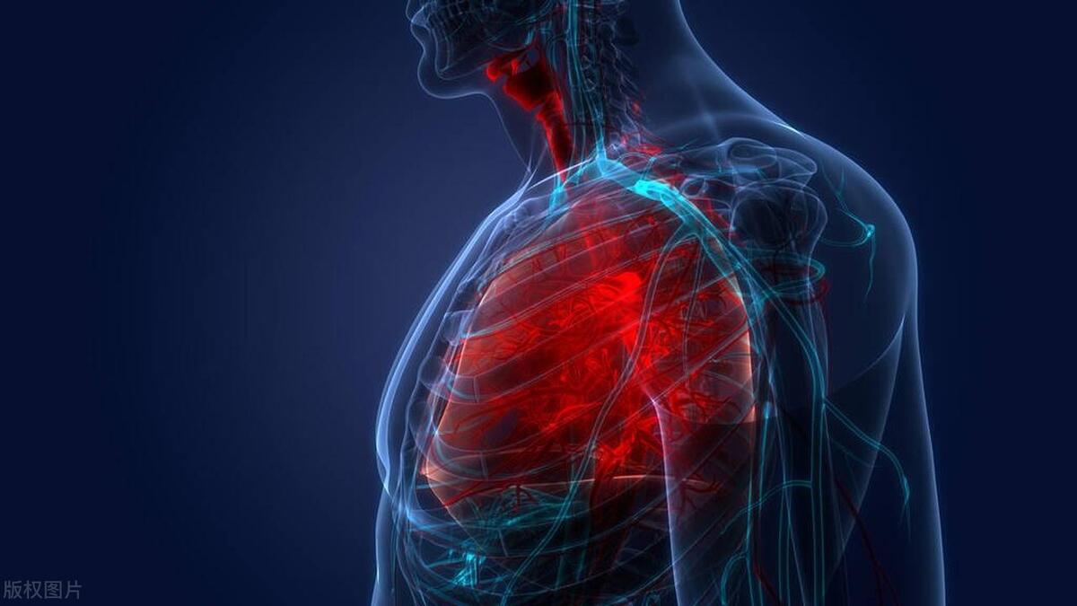 肺癌有高危因素应该化疗还是放疗,得了肺癌还能活多久取决于3点