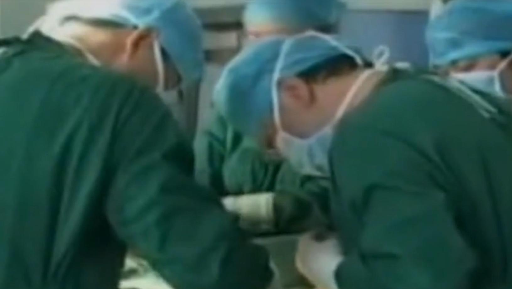 云南男子口臭手术后现在怎么样了,云南男子口臭查出了大毛病