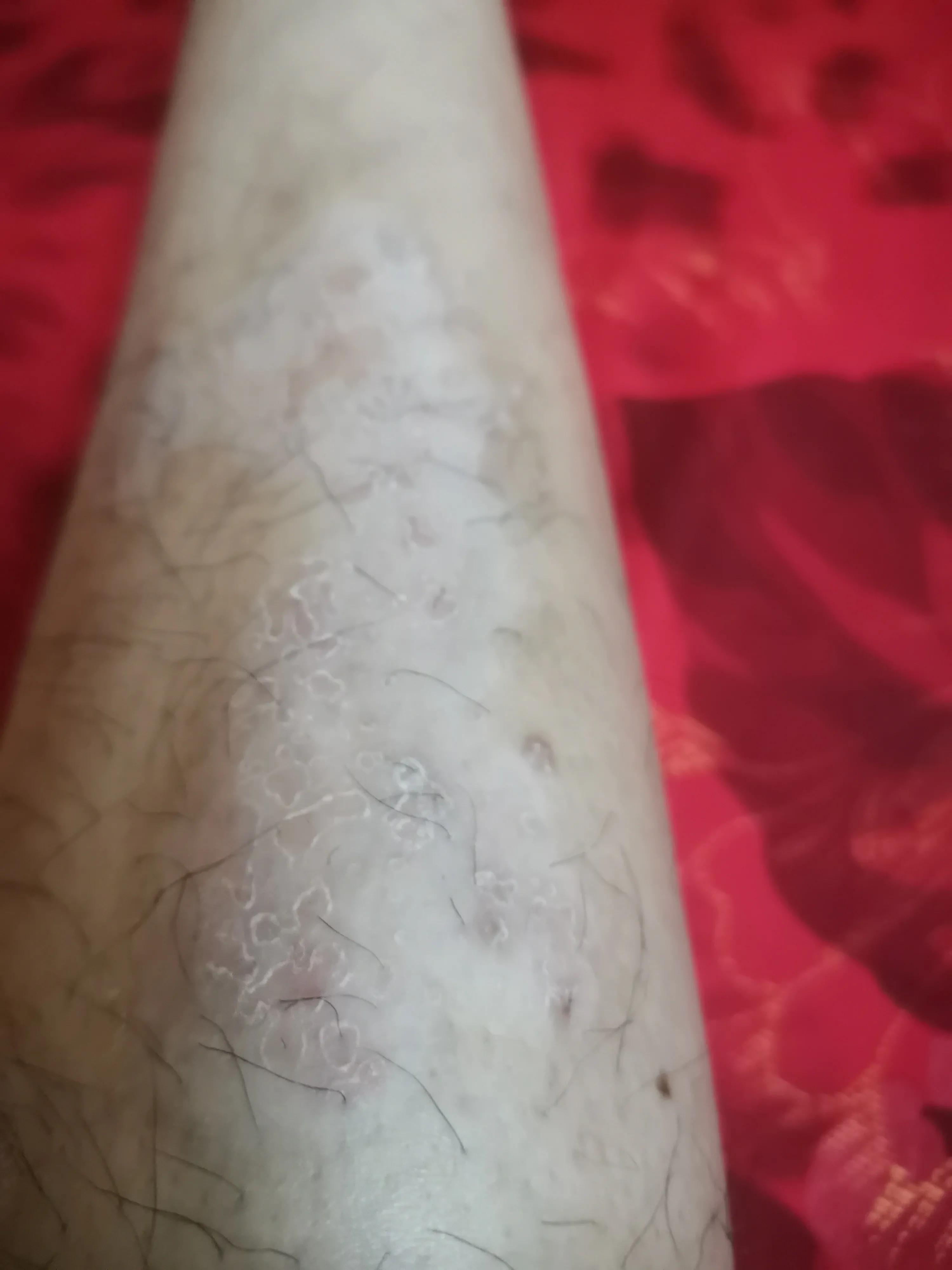 喝骨头汤可以防治骨质疏松,中药汤治骨质疏松