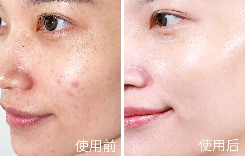 瓷妆依克多因精华好用吗,瓷妆依克多因舒润特护精华液测评