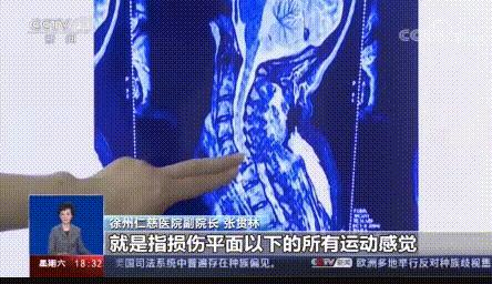 全身瘫痪下身撕裂危险运动,全身瘫痪女孩被网红运动毁掉