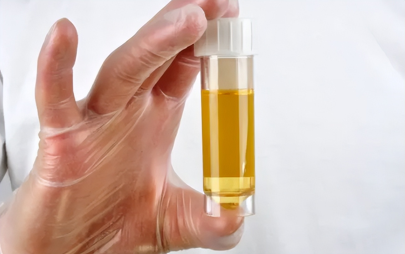 夜尿次数怎么计算,夜尿量多2-3次警惕三种病