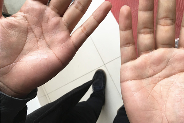 掌纹图谱大全男生断掌,掌纹很多是什么寓意