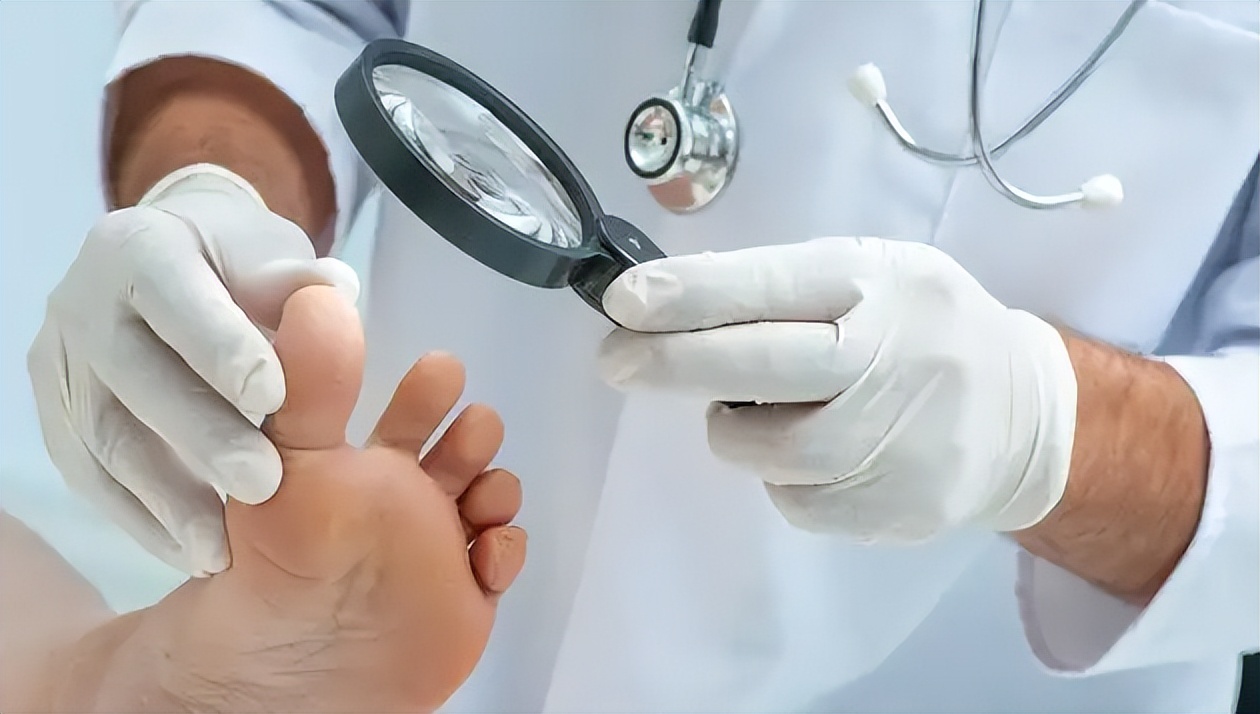 得了甲沟炎一定要拔指甲就能好吗,甲沟炎指甲陷肉里拔不出来怎么办