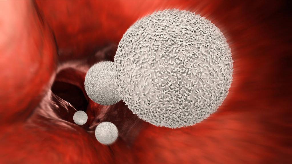 尿酸高吃的药对人伤害大吗,非布司他降尿酸后怎么保持低尿酸