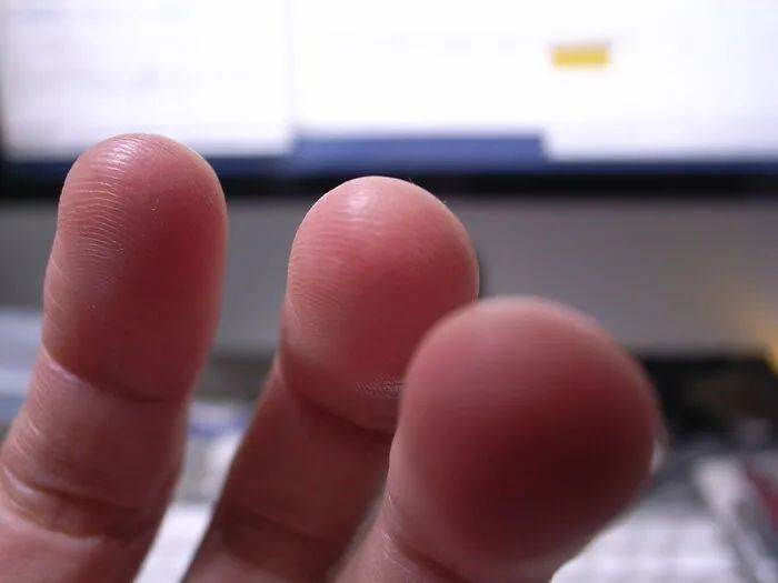 “医生见过病人对人体最愚蠢的误解是啥？”简直震惊了