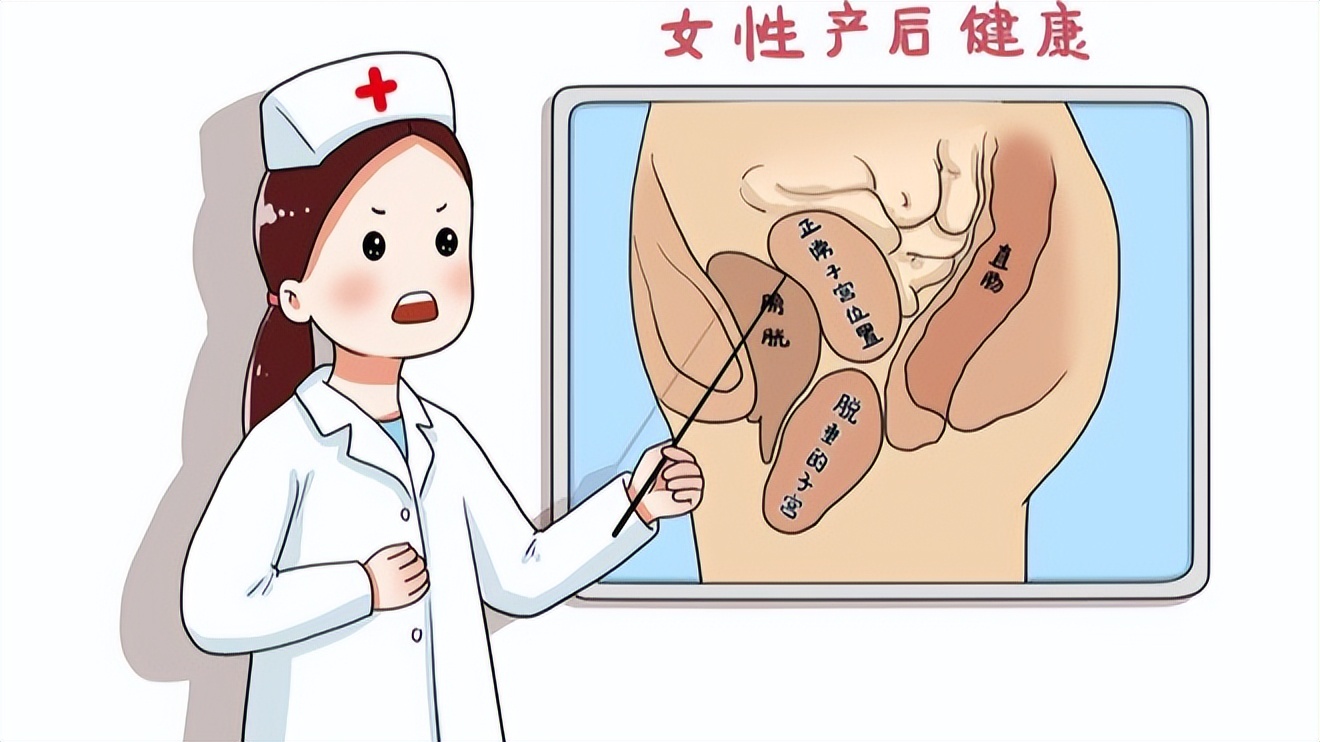 子宫脱垂有哪些病症,子宫脱垂属于重大疾病么