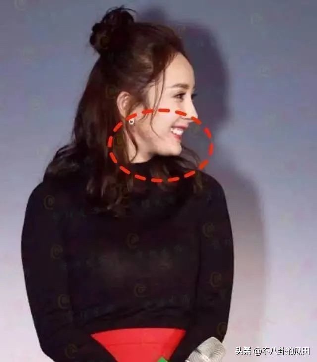 蔡徐坤下巴太尖惹争议图片,蔡徐坤下巴是假体吗