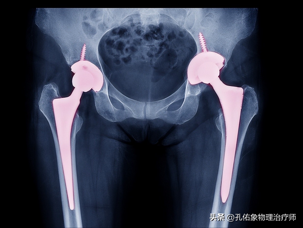 胯骨疼痛警惕四种病,身体有病是什么感觉