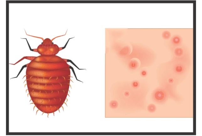 多国出现床虱原因,多国床虱大爆发床虱最怕什么东西
