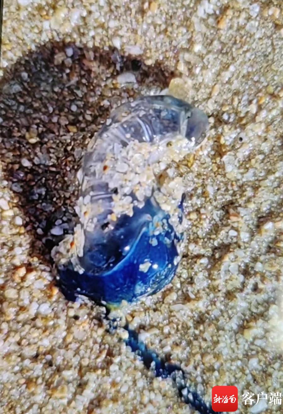 游客下海玩水被水母蛰伤海南急诊科医生：水母蜇伤注意这四点