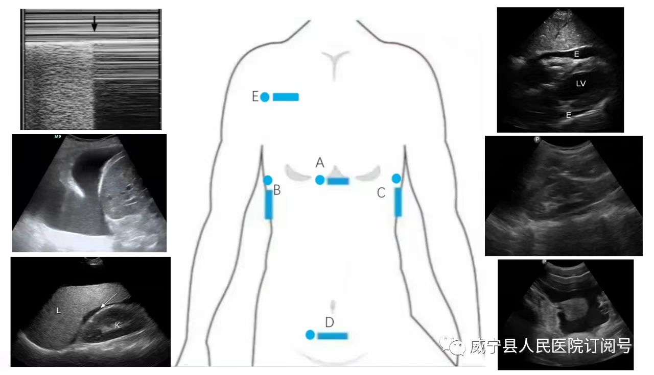 创伤医疗器械工具,创伤急救的fast原则