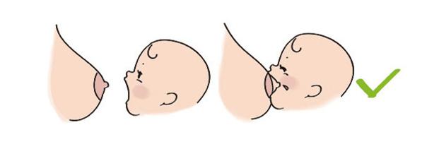 宝妈得乳腺炎怎样治疗,宝妈得了乳腺炎最快的治疗办法