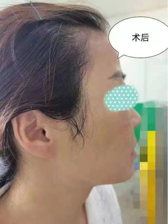 菏泽市立医院口腔科：重塑容颜让美丽依旧