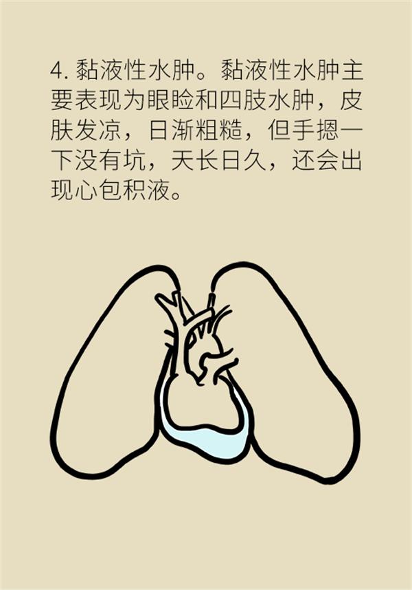 身体出现水肿需要做哪些检查,身体出现水肿吃什么药好