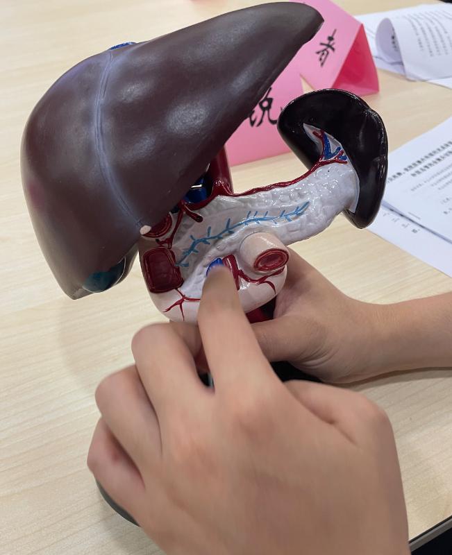 胰腺肿瘤切掉是不是代表没事了,胰腺出现肿瘤对其他脏器的影响