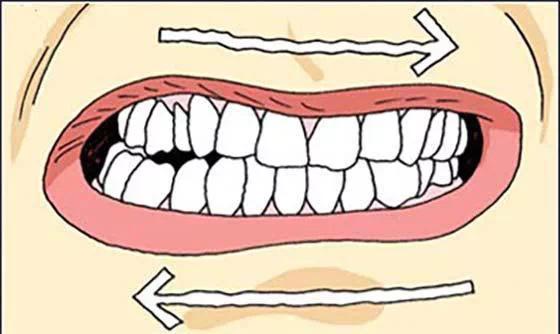 睡觉磨牙时还梦到自己磨牙,睡觉多梦并磨牙是属于睡眠障碍吗