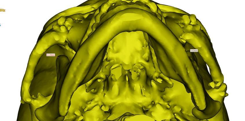 涉“性侵疑云”后，上海一整形男医生又卷入数起医疗纠纷被投诉，谁之过？