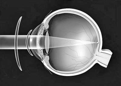 近视合并老花眼怎样配眼镜呢,近视眼遇上老花眼